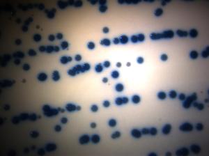 Typical blue colored MRSA colonies on MRSA ID Agar